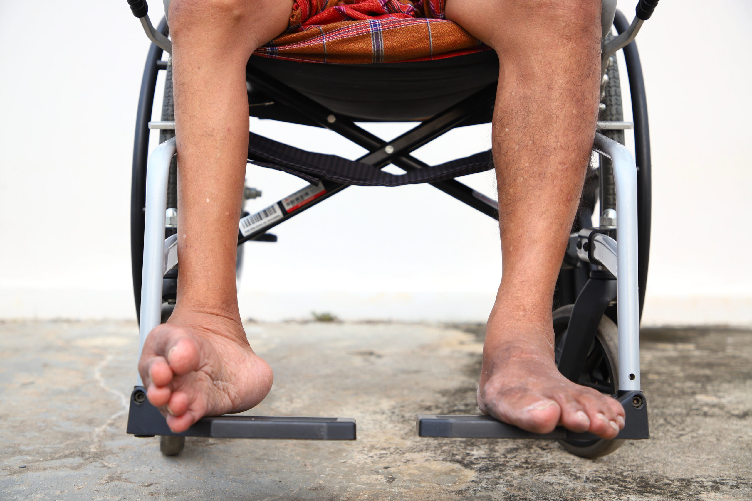 Professor Oyewale Tomori und sein Kampf gegen Polio in Nigeria Buzzard